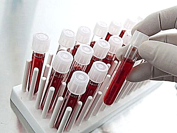 Menguraikan kode tes darah pada anak-anak