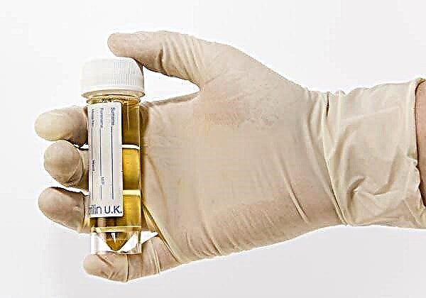 Epitélio escamoso na urina de uma criança