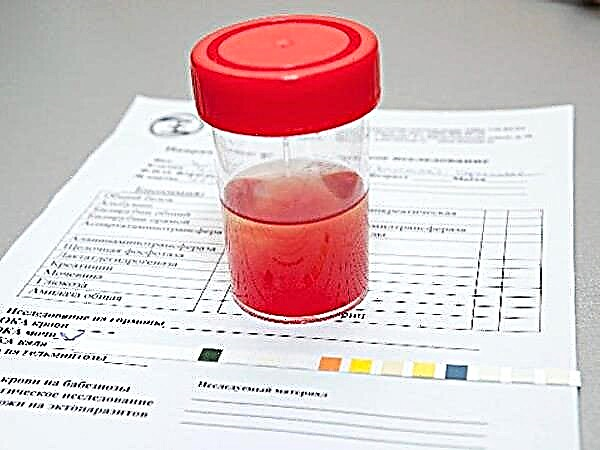 Erythrocytes in the urine of a child