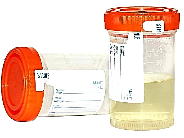Normen for leukocytter i barnets urin og årsakene til økte verdier