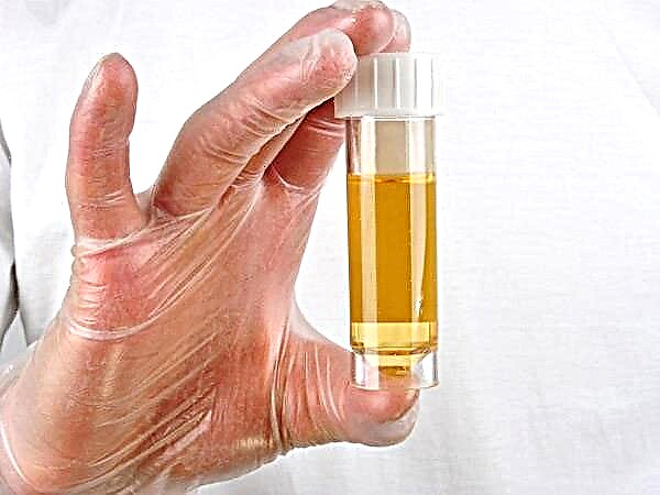 Protein in the urine of a child