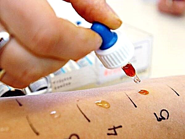Çocuklarda alerjenler için deri testleri