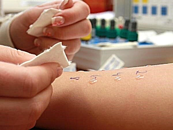 Allergitester for barn og deres typer