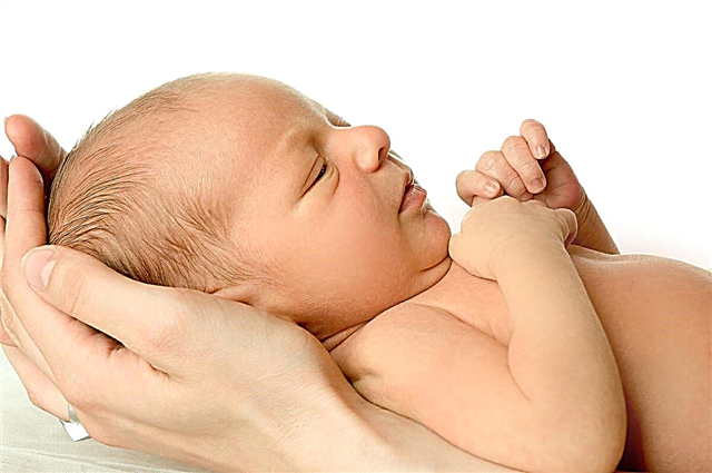 Kā pārbaudīt bilirubīna līmeni jaundzimušajiem?