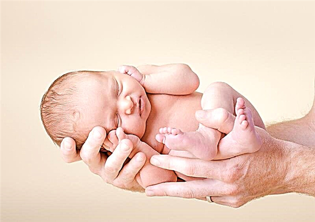 Wie kann man Neugeborenen mit Gelbsucht Hofitol geben?
