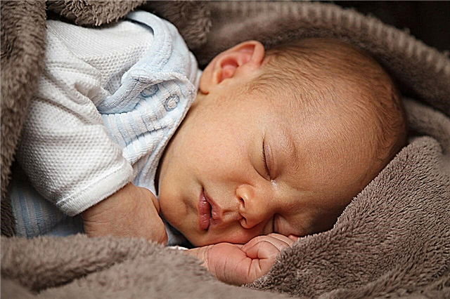 Hemolitička žutica u novorođenčadi
