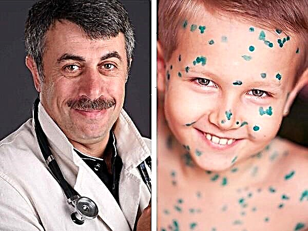 Docteur Komarovsky: qu'est-ce que la varicelle et comment la traiter