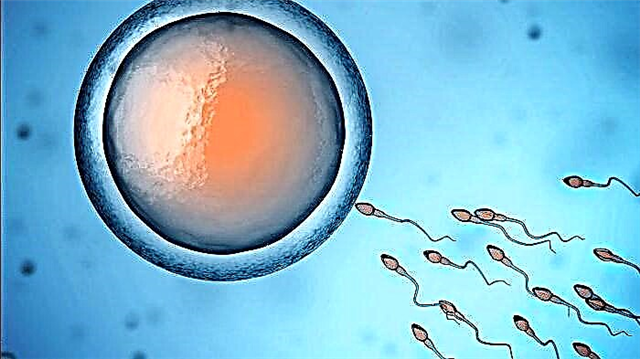 Що таке олигоспермия і як вона впливає на зачаття?