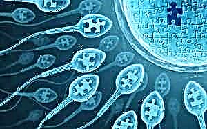 Spermogramnormer, dekoding av indikatorer og årsaker til avvik
