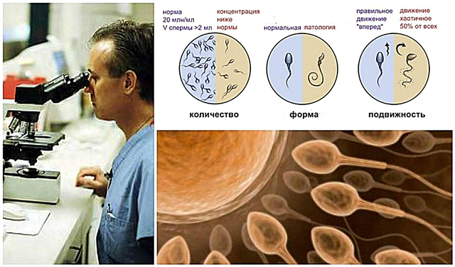 Kaip pagerinti spermogramos morfologiją ir kokius vaistus pasirinkti?