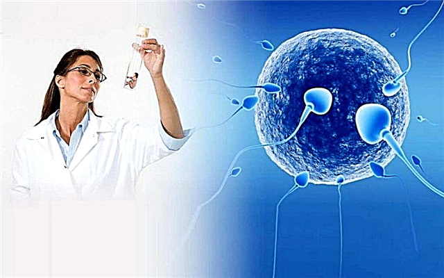 Vad är ett spermogram och vad visar det? Vad ska jag göra om det finns patologiska former?