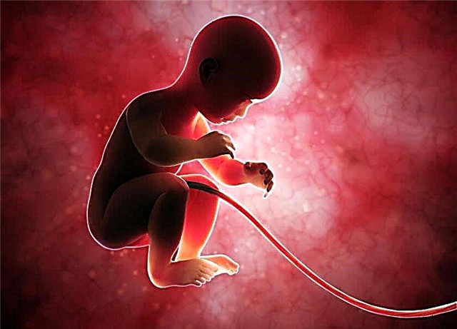 Soorten koordbevestigingen en effecten op de foetus