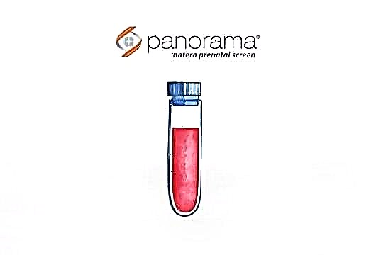 Why is the Panorama test done during pregnancy and what are the reviews about it?