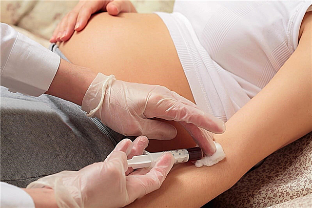 Hva bør være normal blodurea under graviditet? Årsaker til avvik