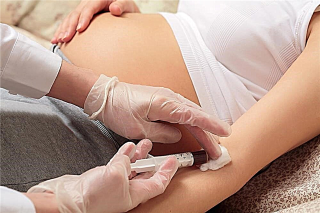 Blodsockertest hos gravida kvinnor: normer och orsaker till avvikelser
