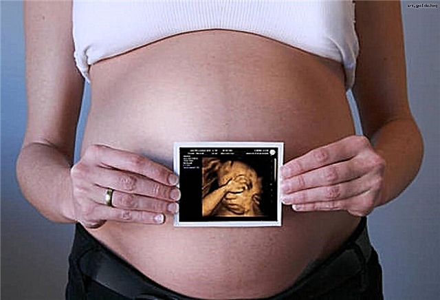 Ultrassom 3D durante a gravidez