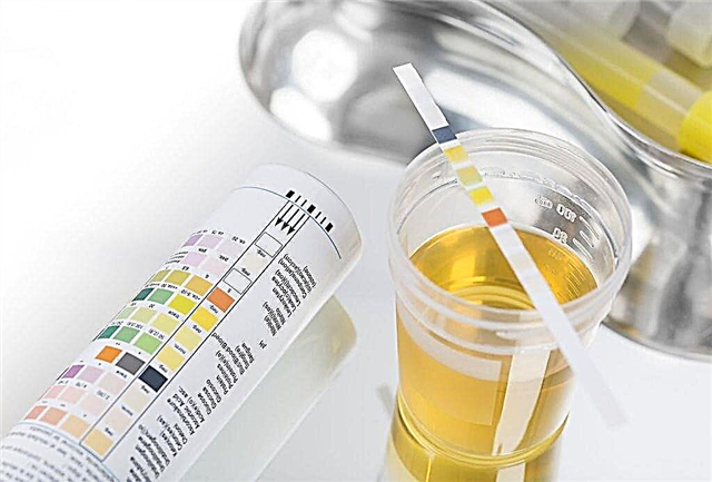 Analyse d'urine selon Nechiporenko pendant la grossesse