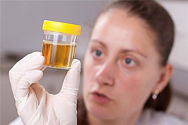 Regras para passar em um teste de urina durante a gravidez