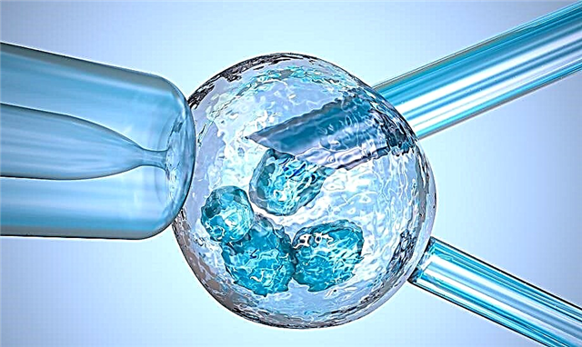 IVF uden hormonel stimulering i den naturlige cyklus