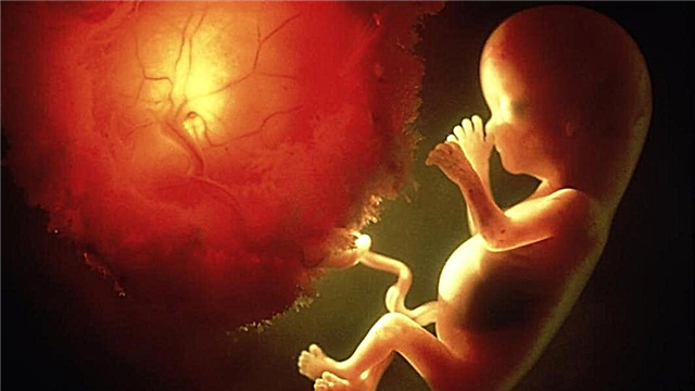 ¿Qué es la placenta? ¿Cuáles son sus funciones y cómo se ve?