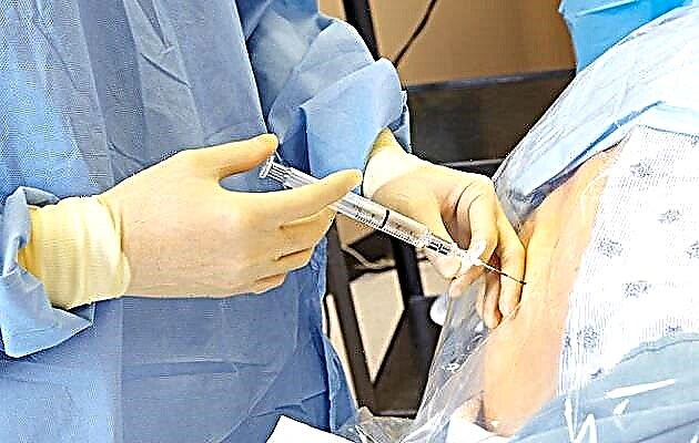 Possíveis consequências da anestesia peridural durante o trabalho de parto