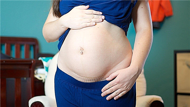 ¿Cuántos meses puedo tener un bebé después de una cesárea?