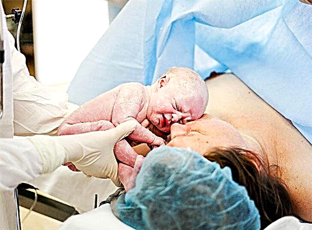 How long does a cesarean section take and what determines the duration of the operation?