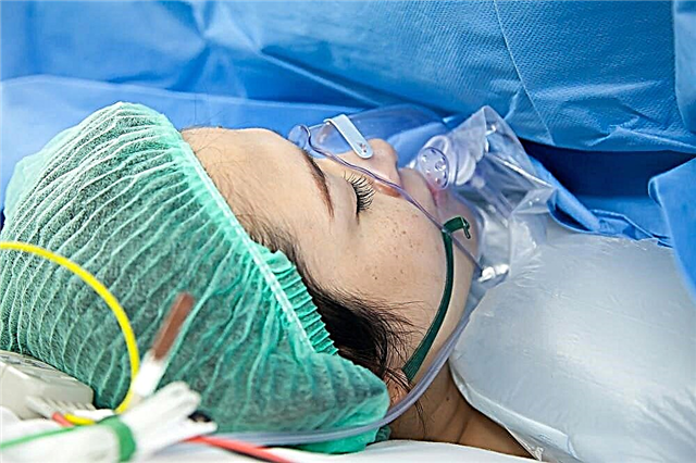 Algemene anesthesie voor een keizersnede