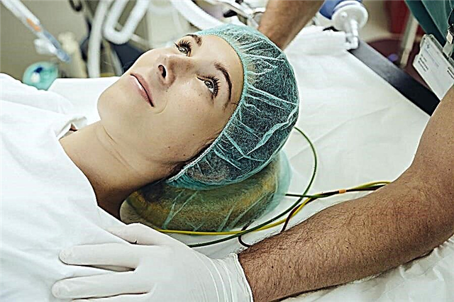 Qual è la migliore anestesia per un taglio cesareo?