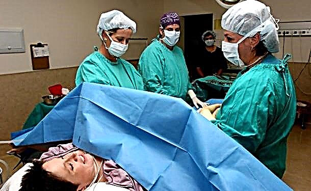 Anestesi epidural untuk operasi caesar