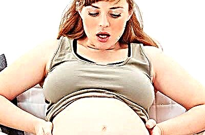 Öffnet sich der Gebärmutterhals bei Kontraktionen immer und kann der Prozess schmerzfrei sein?