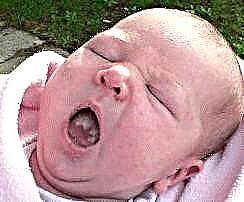 Bílá deska na jazyku novorozence - co to je? Jak odstranit?