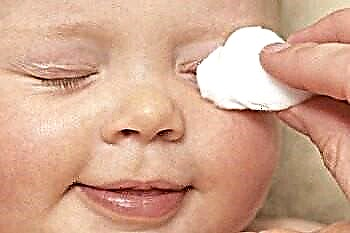 Cura degli occhi del neonato