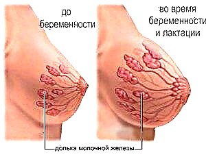 Pielęgnacja piersi po porodzie w okresie karmienia piersią