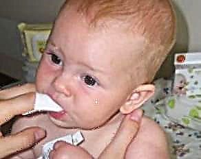 Recognizing and treating thrush in the mouth in newborns