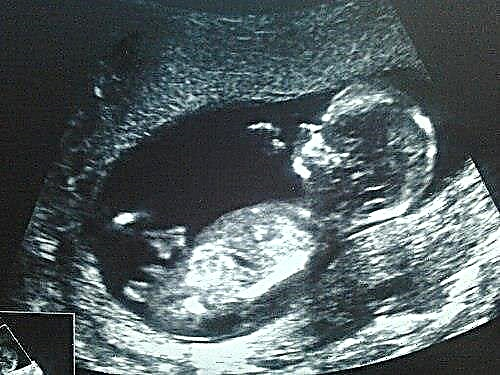 13 weken zwanger