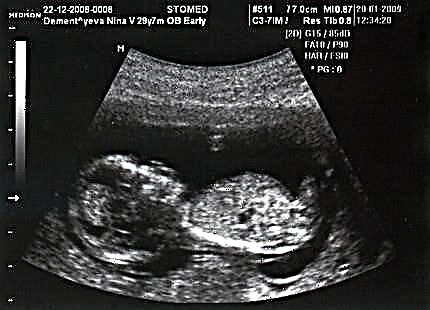 14 settimane di gravidanza