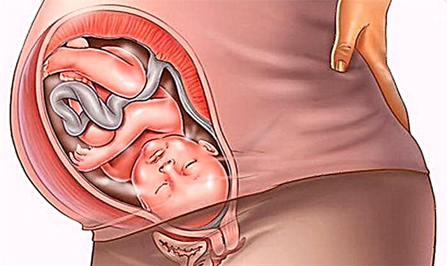 42 weken zwanger: de bevalling begint niet - wat te doen
