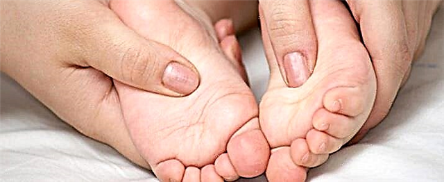 Preprečevanje ploskih stopal pri otrocih na naraven način