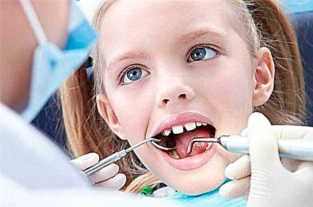 Како правилно уклонити млечни зуб од детета без суза код куће и код зубара: савети, методе и видео упутства